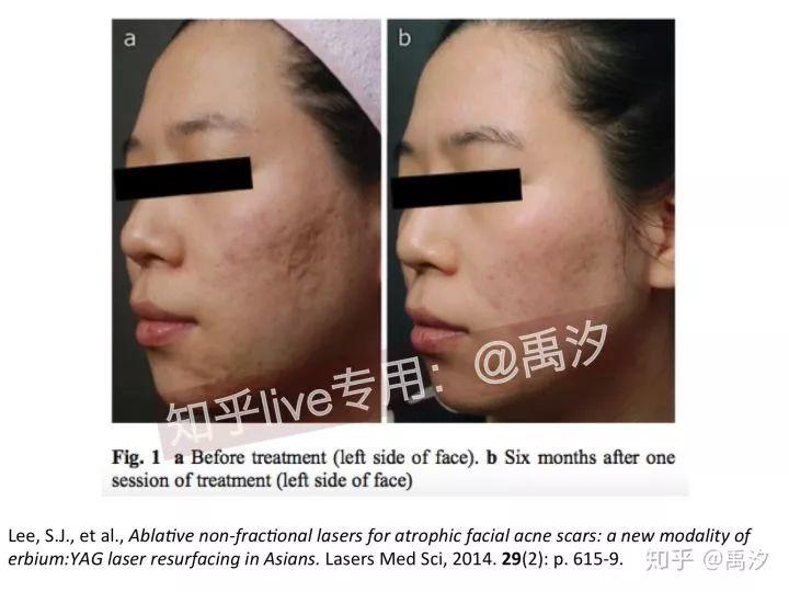 知乎观潮 | 如何有效抗衰老? 知乎观潮 | 如何有效抗衰老?